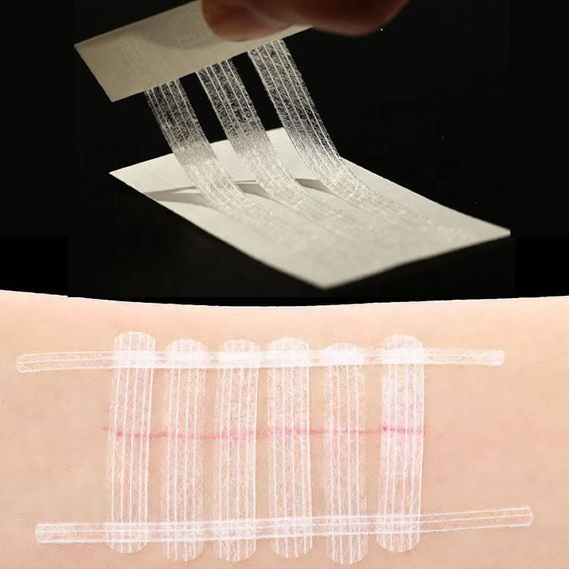Одноразовая стерильная клейкая полоска для закрытия ран на коже